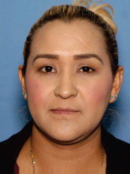 Wanted Fugitive Araceli Medina