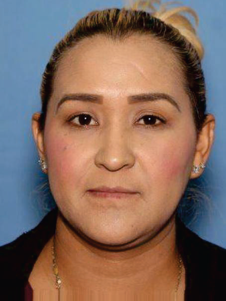 Fugitive Araceli Medina